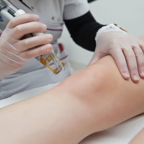 7 Benefits of Laser Hair Removal According to Experts
